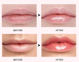 Éclat Gloss ™- Voluminizador Labial con Ácido Hialurónico