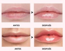 1+1 Gratis Éclat Gloss ™- Voluminizador Labial con Ácido Hialurónico